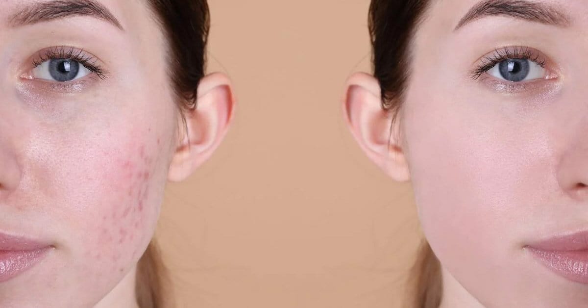 Protection-de-la-peau-utiliser-les-produits-svr-dans-votre-routine-beaute